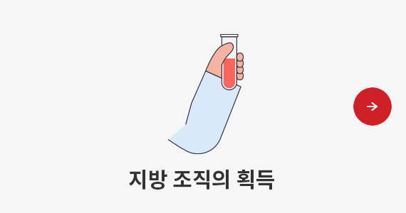 지방 조직의 획득 